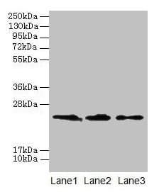 Polyclonal Rabbit anti-Human Claudin 20 / CLDN20 Antibody (WB)