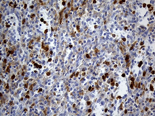 Monoclonal Mouse anti-Human UBE3B Antibody (clone OTI3F10, aa768-1068, IHC)