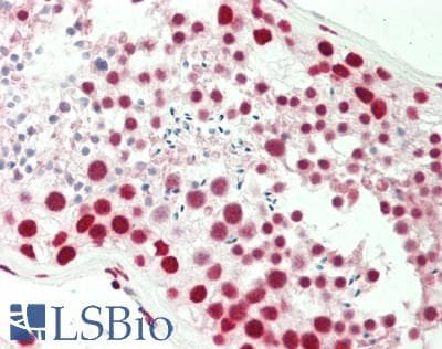 IHC-plus™ NONO / P54NRB Antibody (aa350-400)
