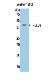 ACE / CD143 Antibody (aa504-597, Cy3)