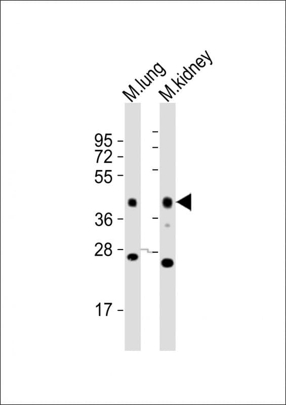 IHC-plus™ EPCAM Antibody (aa217-251)
