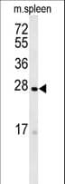 TMEM134 Antibody (aa21-50)