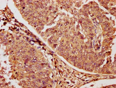 RAC1 Antibody