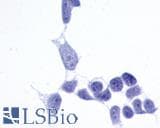 PathPlus™ Polyclonal Rabbit anti-Human FZD6 / Frizzled 6 Antibody (N-Terminus, IHC)