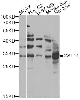 GSTT1 Antibody