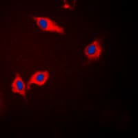 CSNK1A1 / CK1 Alpha Antibody (Internal)