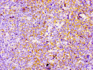 Recombinant Monoclonal Rabbit anti-Human CR2 / CD21 Antibody (IHC, IF, WB)