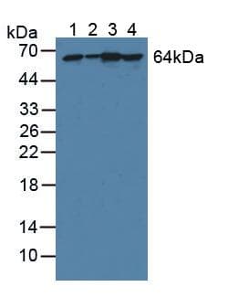 PGM1 / Phosphoglucomutase 1 Antibody (aa1-235)