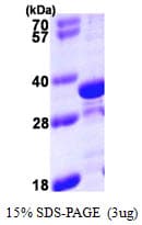 Human TPM4 Protein (Recombinant His)