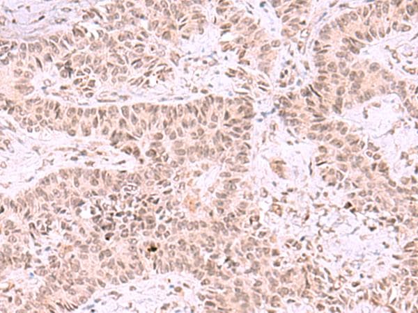 MCMBP / C10orf119 Antibody