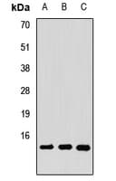 Polyclonal Rabbit anti-Human CLP / COTL1 Antibody (IHC, WB)