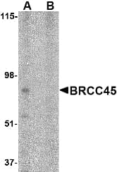 IHC-plus™ BRCC45 / BRE Antibody