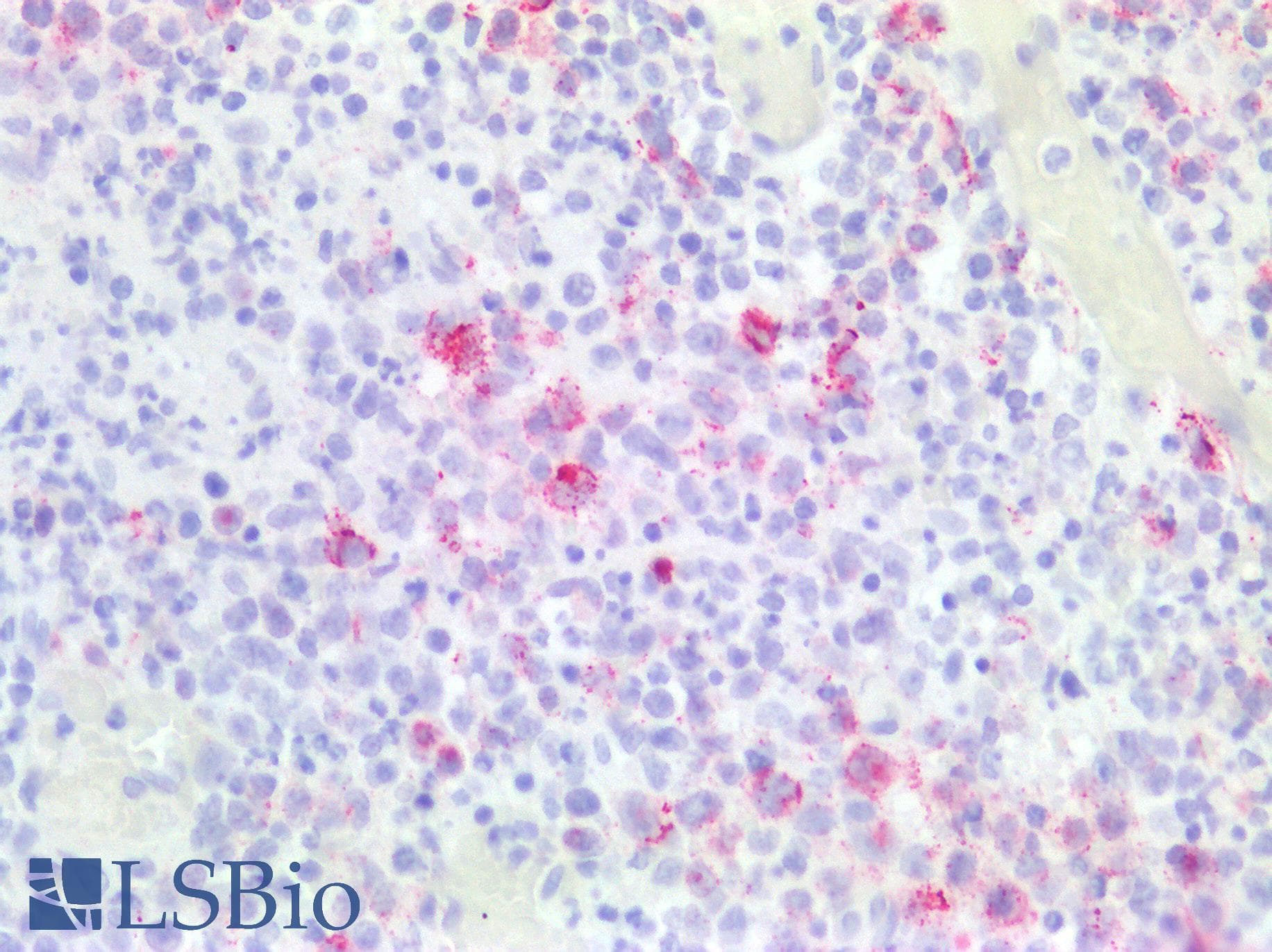 PathPlus™ EBV LMP Antibody (clone CS1-4)