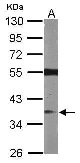 Polyclonal Rabbit anti-Human RASSF2 Antibody (aa1-293, WB)