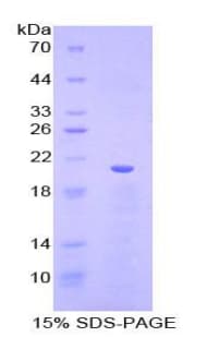 Pig VWF / Von Willebrand Factor Protein (Recombinant His)
