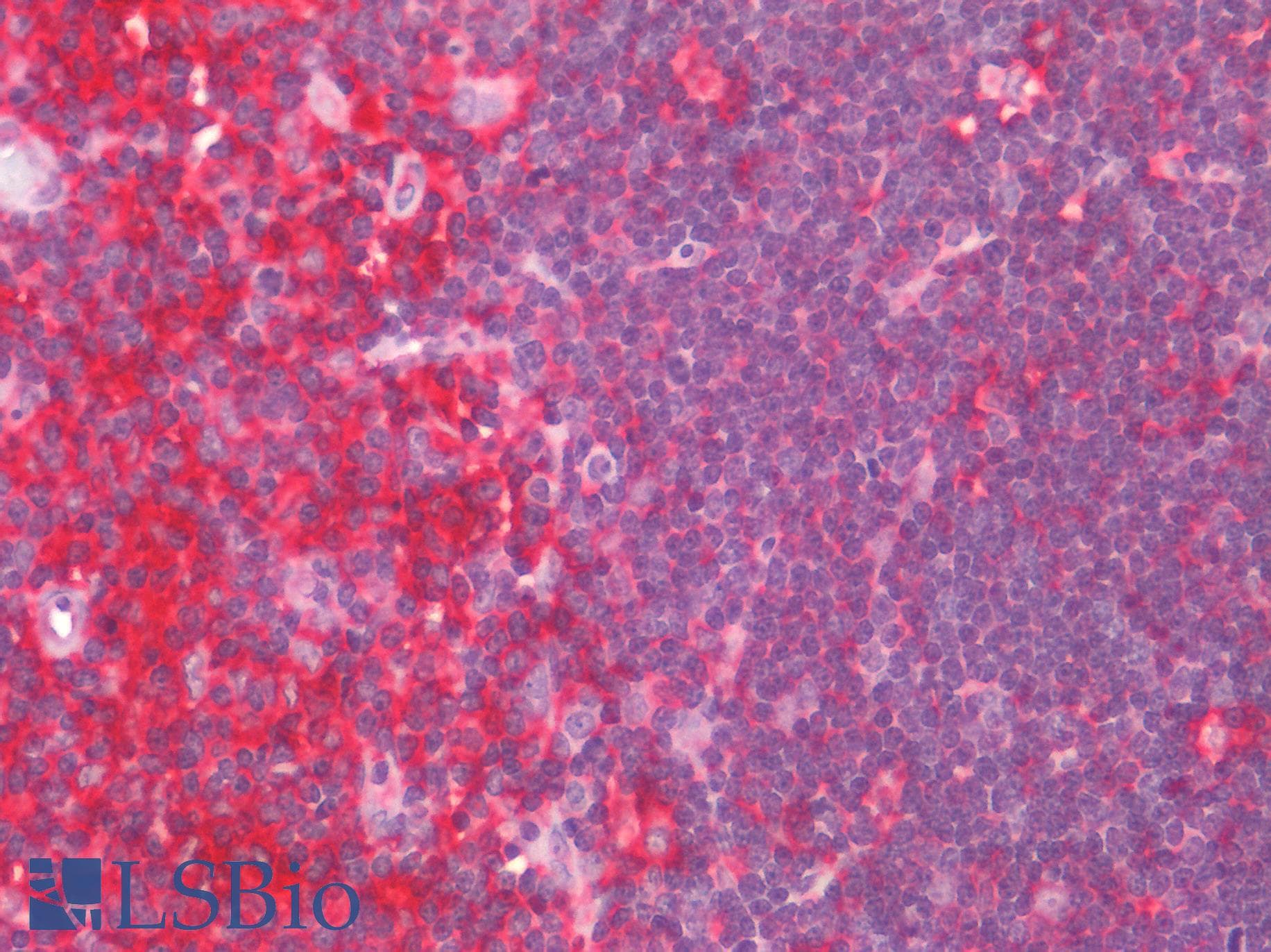 IHC-plus™ CCR6 Antibody (Extracellular Domain)