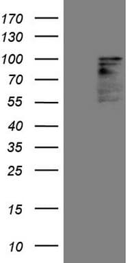 HIPK1 Antibody (aa439-697, clone OTI1G5)