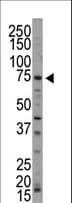 NUAK1 / ARK5 Antibody (aa604-634)