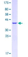 Human CD36 Protein (Recombinant GST, N-terminus)