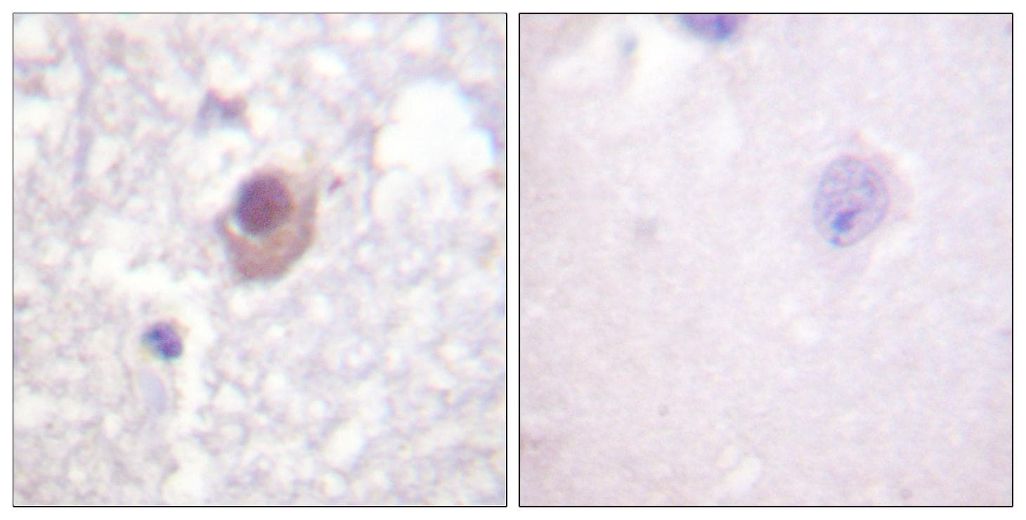 Polyclonal Rabbit anti-Human SGK1 / SGK Antibody (p78, IHC, IF, WB)