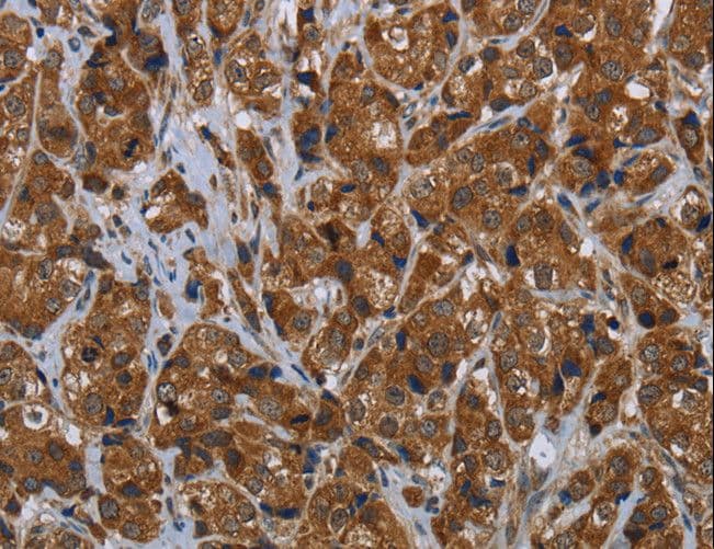 ARHGEF12 Antibody