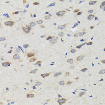 SIAH1 Antibody