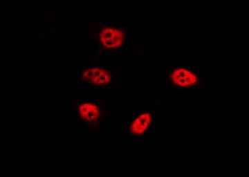 HIST1H2AE Antibody (Acetyl-Lys9)
