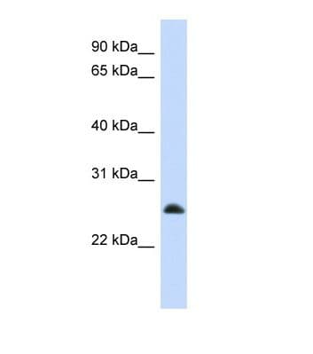 MRPL10 Antibody (N-Terminus)