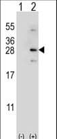 NDUFS4 Antibody (aa131-160)