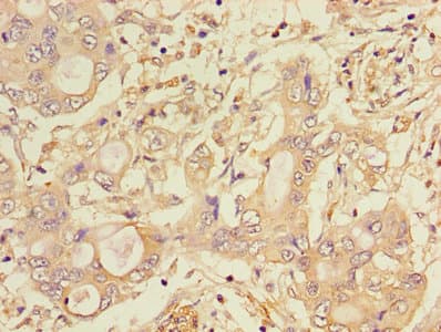 CTSA / Cathepsin A Antibody