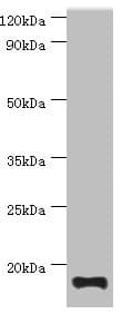 IHC-plus™ TNNC2 Antibody (aa1-160)