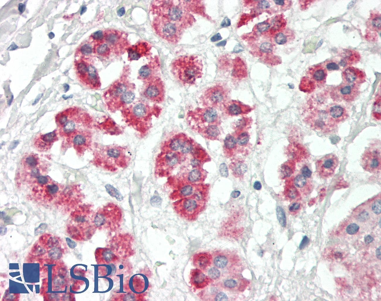 Polyclonal Rabbit anti-Human SIGLEC9 Antibody (aa308-357, IHC, WB)