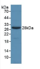 A2M / Alpha-2-Macroglobulin Antibody