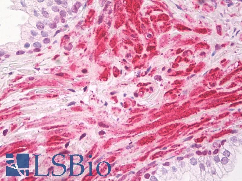 KIAA0191 / ZCCHC11 Antibody (aa1403-1452)