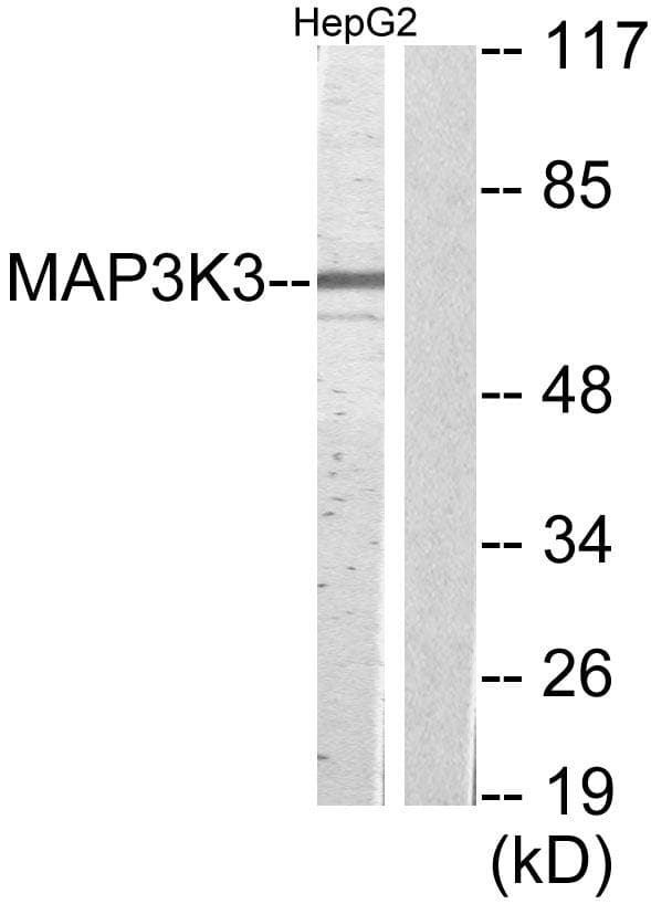 Polyclonal Rabbit anti-Human MAP3K3 / MEKK3 Antibody (WB)