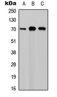 IHC-plus™ CSF1 / MCSF Antibody (C-Terminus)