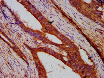 UNC84B / SUN2 Antibody