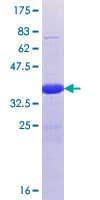 Human LCX / TET1 Protein (Recombinant GST, N-terminus)