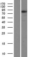 ZNF167 Protein (Over-Expression Lysate Myc-DDK (Flag))