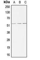 Polyclonal Rabbit anti-Human ACVRL1 Antibody (Internal, IHC, IF, WB)