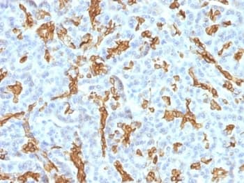 KRT19 / CK19 / Cytokeratin 19 Antibody (clone KRT19/799 + KRT19/800, Azide-free, BSA-free)