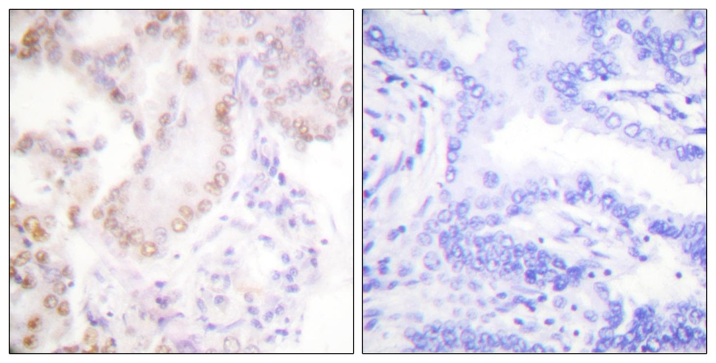 RPS6KB1 / P70S6K / S6K Antibody