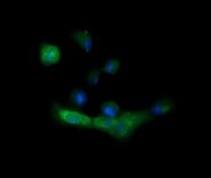 MLANA / Melan-A Antibody (clone OTI3A2)