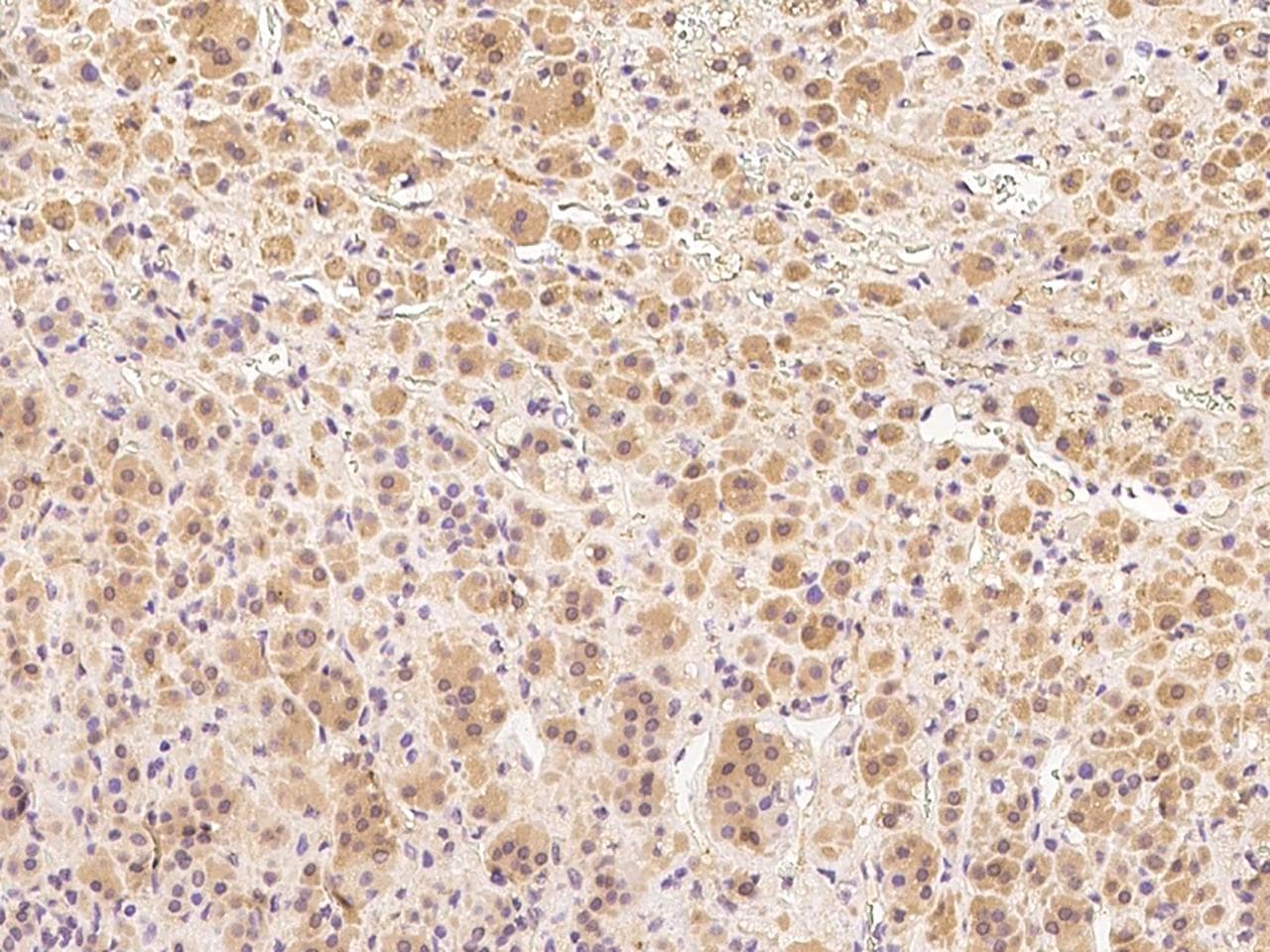 Polyclonal Rabbit anti-Human CCNB2 / Cyclin B2 Antibody (IHC)