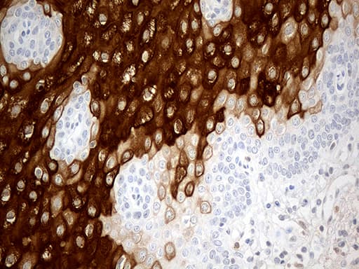 CRNN / Cornulin Antibody (clone OTI4B8)