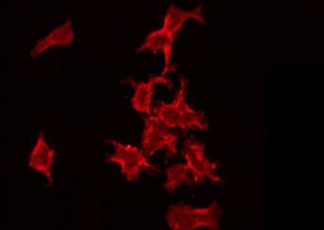 Polyclonal Rabbit anti-Human NRIP3 Antibody (IHC, IF, WB)