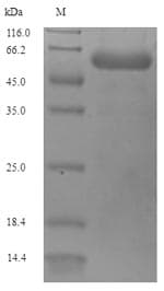 Pseudomonas aeruginosa OmpD Protein (Recombinant 6His-SUMO, N-terminus)