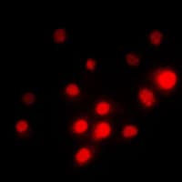 PathPlus™ TFE3 Antibody (Internal)