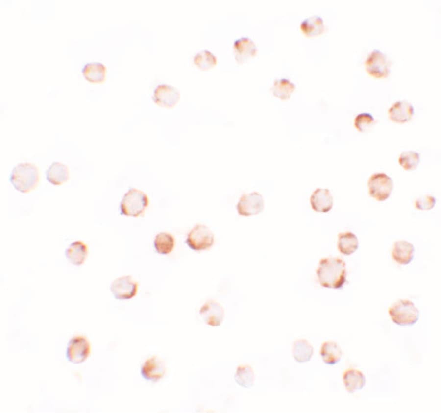 IHC-plus™ Polyclonal Rabbit anti-Human EPM2A / Laforin Antibody (IHC, IF, WB)
