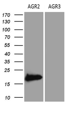 AGR2 Antibody (aa21-175, clone OTI2D11)